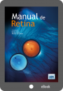 (EBook) Manual de Retina